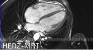 Herz MRT
