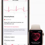 Apple-iPhone-watch-ecg-de-screen-03272019