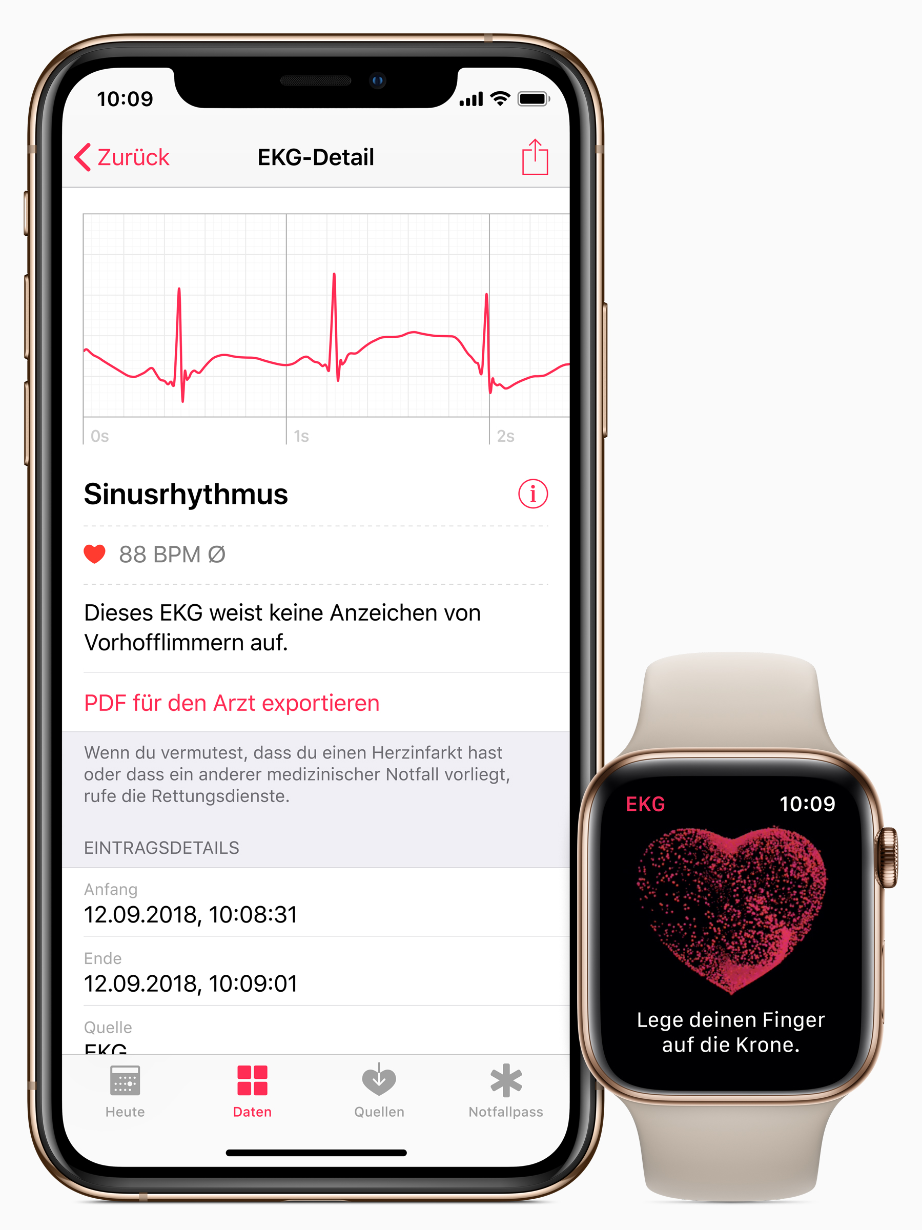 ecg in iphone watch